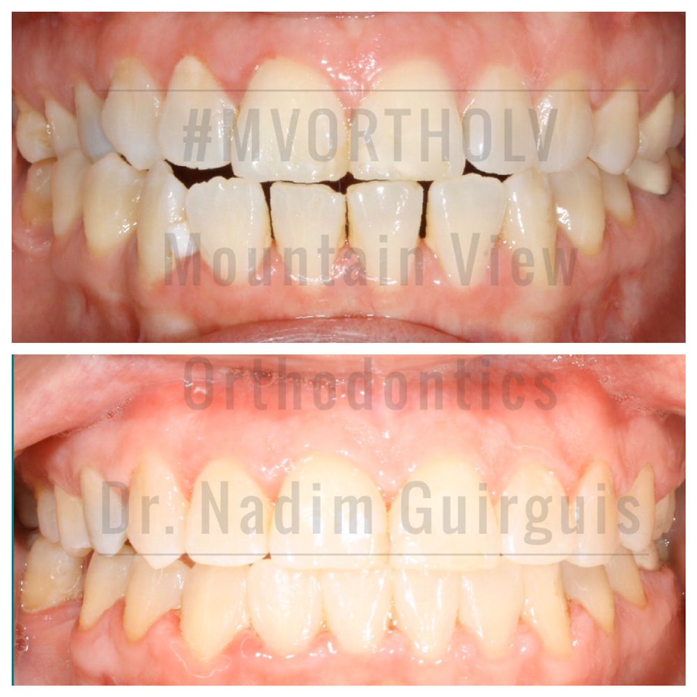 MOUNTAIN VIEW ORTHODONTICS 14 Photos & 25 Reviews 1811 S Rainbow