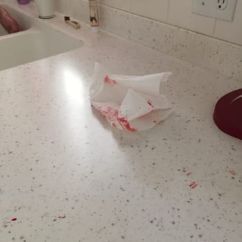 Dawg Gone Pet Salon - Blood splatters - Pet Groomers Near Me - Harrisville, Utah Dawg Gone Pet Salon - Blood splatters - Pet Groomers Near Me - Harrisville, Utah