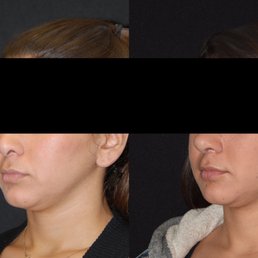 Z. PAUL LORENC, M.D, F.A.C.S - Updated October 2025 - 31