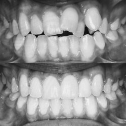 Walker Orthodontics