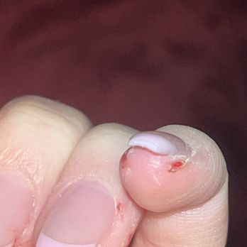 Le's Nail & Spa - They filed down on my skin with no apology - Day Spas Near Me - Ventura, California Le's Nail & Spa - They filed down on my skin with no apology - Day Spas Near Me - Ventura, California