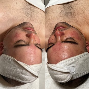 MNC3Skin - Calming and soothing treatments available - Estheticians Near Me - Colton , California MNC3Skin - Calming and soothing treatments available - Estheticians Near Me - Colton , California