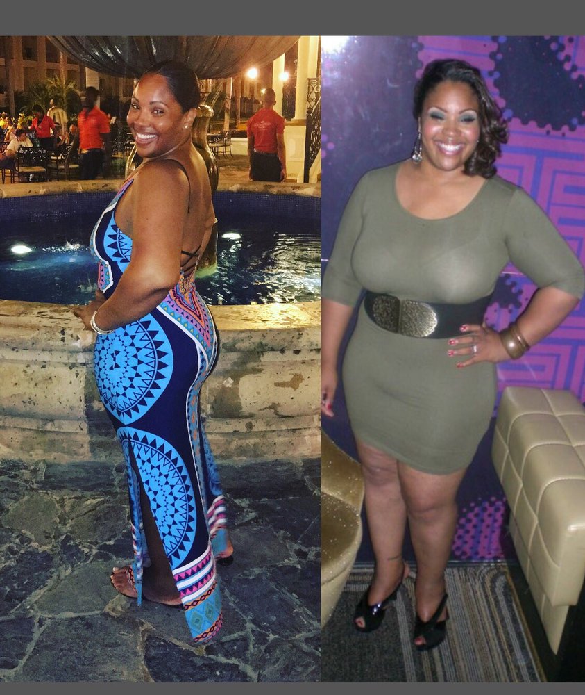 PRECISION WEIGHT LOSS CENTER Updated September 2024 19 Photos & 31