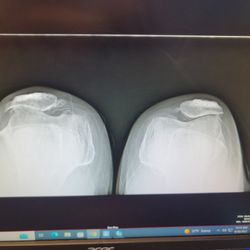 Bluegrass Orthopaedics