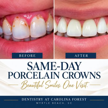 Dentistry at Carolina Forest - Porcelain Crowns Completed in One Visit - General Dentistry Near Me - Myrtle Beach, South Carolina Dentistry at Carolina Forest - Porcelain Crowns Completed in One Visit - General Dentistry Near Me - Myrtle Beach, South Carolina
