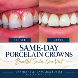 Dentistry at Carolina Forest - Porcelain Crowns Completed in One Visit