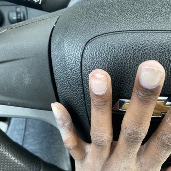 Stop 4 Nails - My finger right after service (the finger they assisted me could still have a tip) - Nail Salons Near Me - Bellevue, Washington Stop 4 Nails - My finger right after service (the finger they assisted me could still have a tip) - Nail Salons Near Me - Bellevue, Washington