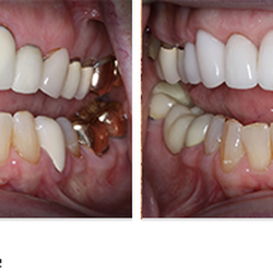 Cedar Hills Family Dentistry