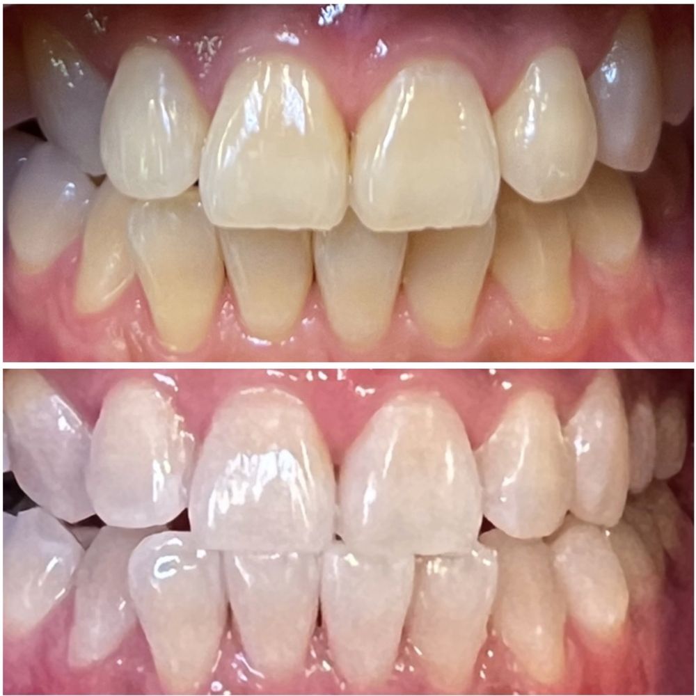 Before and after Before and after