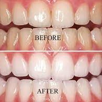 Royalty Luxury Spa - Teeth Whitening Near Me - Saint Louis, Missouri Royalty Luxury Spa - Teeth Whitening Near Me - Saint Louis, Missouri