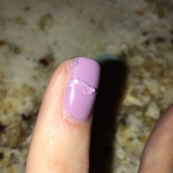 Omnia Nail Spa - Multiple coats of gel were put on, without being cured. Less than an hour later the top layers were already peeling - Hair Removal Near Me - Glen Mills, Pennsylvania Omnia Nail Spa - Multiple coats of gel were put on, without being cured. Less than an hour later the top layers were already peeling - Hair Removal Near Me - Glen Mills, Pennsylvania