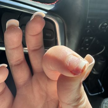 Famous Nails - A close-up of a person's hand with long, manicured nails, showing a bleeding thumbnail. The hand is positioned inside a vehicle, with the dashboard, steering wheel, and control buttons visible in the background. The person appears to have sustained an injury to the thumbnail, which is bleeding. - Nail Salons Near Me - Albuquerque, New Mexico