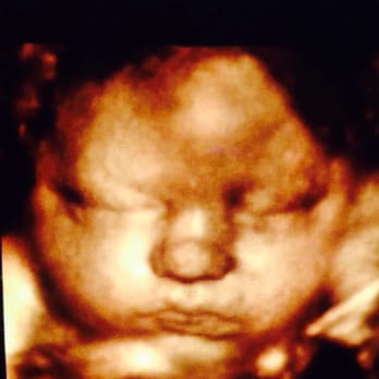 InVision 3D4D Ultrasound - Ruby Rae Greene - Parenting Classes Near Me - Folsom, California