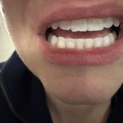Westlake Smile Studio: Mimi Theerathada, D.M.D