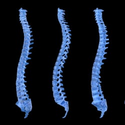 Acceleration Physical Therapy