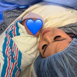 After C Section After C Section