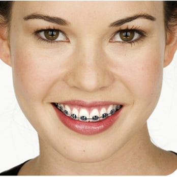 Azariy Yusupov, DDS - Orthodontists Near Me - Brooklyn, New York Azariy Yusupov, DDS - Orthodontists Near Me - Brooklyn, New York
