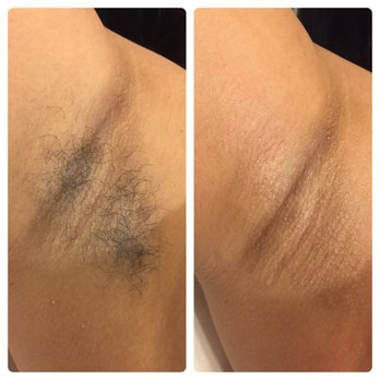 Beyond Beauty Boutique - Underarm Wax. Beyond Beauty Boutique loves the Skin Your in! - Waxing Near Me - Houston, Texas Beyond Beauty Boutique - Underarm Wax. Beyond Beauty Boutique loves the Skin Your in! - Waxing Near Me - Houston, Texas