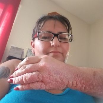 With Love & Co - My fingers used to crack, now inflammation is minimal. - Cosmetics & Beauty Supply Near Me - Las Vegas, Nevada With Love & Co - My fingers used to crack, now inflammation is minimal. - Cosmetics & Beauty Supply Near Me - Las Vegas, Nevada