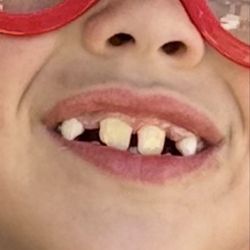 Fairfield Orthodontics - Before 2024