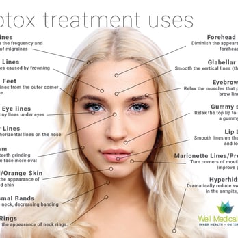 Well Medical Arts - http://www.wellmedicalarts.com/botox/ - Medical Spas Near Me - Seattle, Washington Well Medical Arts - http://www.wellmedicalarts.com/botox/ - Medical Spas Near Me - Seattle, Washington