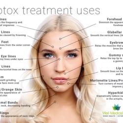 Well Medical Arts - Http://www.wellmedicalarts.com/botox/