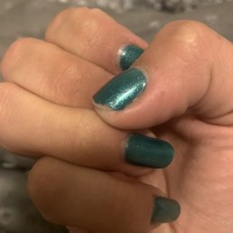 My broken nail