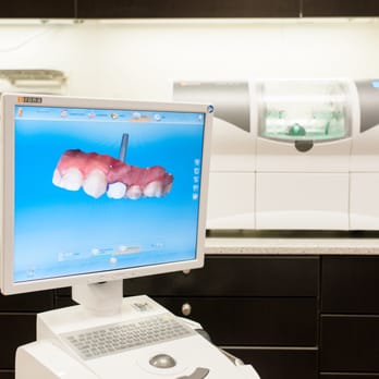 Modern Dental - One visit crowns with CEREC - General Dentistry Near Me - Richardson, Texas
