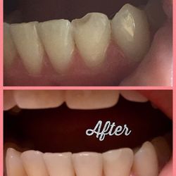 Dentists at Memorial Park - Love Doctor Catalina Cruz. Thank You So Much for fixing my chipped tooth