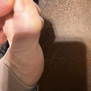 Miracle Nails - Pedi specifically stated calluses were to be addressed. She did not touch ONE! - Nail Salons Near Me - San Antonio, Texas Miracle Nails - Pedi specifically stated calluses were to be addressed. She did not touch ONE! - Nail Salons Near Me - San Antonio, Texas