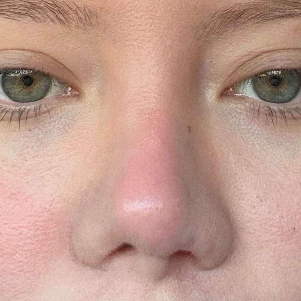 Sozer Sadri, MD - Final result - Cosmetic Surgeons Near Me - El Paso, Texas Sozer Sadri, MD - Final result - Cosmetic Surgeons Near Me - El Paso, Texas