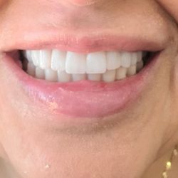 David Cummings,DDS - Finished dental journey.