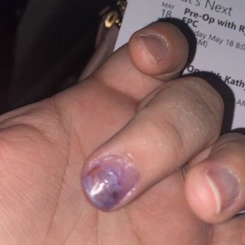 Visible Nails - Here's after I got it glued - Nail Salons Near Me - Millersville, Pennsylvania Visible Nails - Here's after I got it glued - Nail Salons Near Me - Millersville, Pennsylvania