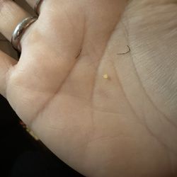 Wahmei Chinese Restaurant - A piece of wire from a metal wire cleaning brush for a grill. Was found in my rice.