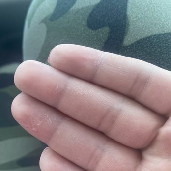 Signature Nails & Spa - USED A CHEMICAL ON MH SKIN THAT LITERALLY MADE IT PEEL AND FLAKE OFF - Nail Salons Near Me - Denver, Colorado Signature Nails & Spa - USED A CHEMICAL ON MH SKIN THAT LITERALLY MADE IT PEEL AND FLAKE OFF - Nail Salons Near Me - Denver, Colorado