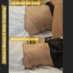Enhance Beauty & Body Sculpting by Elizabeth