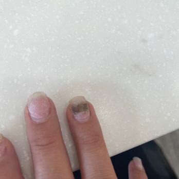 Nails 19 - Fungus caused by the nail technician at nail 19 using dirty tools - Nail Salons Near Me - Roseville, California