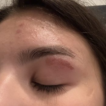 Ulta Beauty - Burn on the left eyebrow - Cosmetics & Beauty Supply Near Me - Chicago, Illinois Ulta Beauty - Burn on the left eyebrow - Cosmetics & Beauty Supply Near Me - Chicago, Illinois