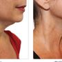 Photo of Glowing Skin Med Spa