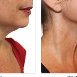 Glowing Skin Med Spa