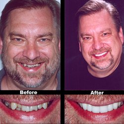 Herbert J Schneider, DMD