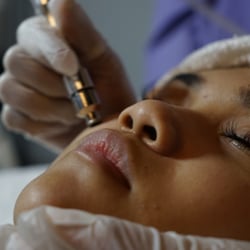 Nulux - Microdermabrasion