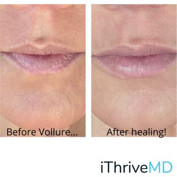 iThriveBeauty UTC - Medical Spas Near Me - La Jolla, California