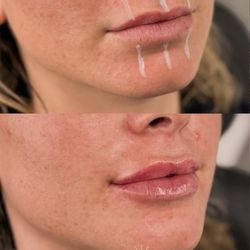 Glowtox Aesthetics