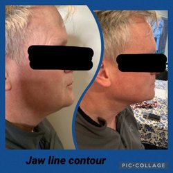 Kristina Ericsson, MD MPH FACOG - Ericsson Aesthetics - Firm Jaw Line