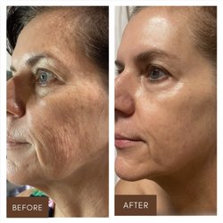 Radiant Facials - Skin and Body Care