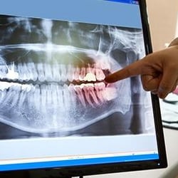 E. Richard Hughes, DDS - E. Richard Hughes, DDS | Sterling, VA
