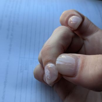 Ugly Nails - Polish peeling off after 9 days. Sent these pics to Nick. - Nail Technicians Near Me - San Jose, California Ugly Nails - Polish peeling off after 9 days. Sent these pics to Nick. - Nail Technicians Near Me - San Jose, California
