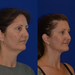 Egozi Plastic Surgery
