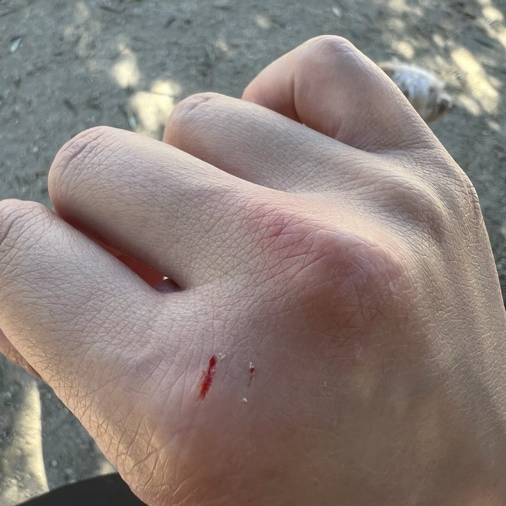 Dog bite Dog bite